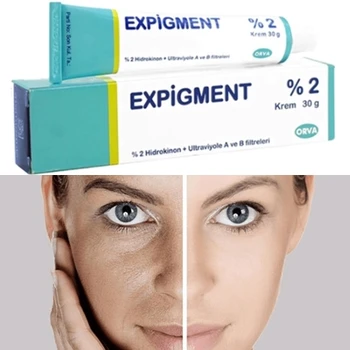 Expigment 30g 1oz Hydroquinone Cream 2% Do wybielania skóry, rozjaśnienie skóry, wybielanie skóry Melasma Anti-blemish