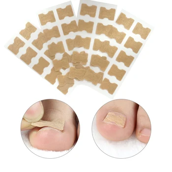 20szt zanokcica (choroba) korektor naklejka połżna paznokci leczenie patch paznokieć naprawa paznokci elastyczne plastry paznokieć wyciągnięcie patch