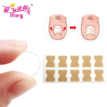 20szt zanokcica (choroba) korektor naklejka połżna paznokci leczenie patch paznokieć naprawa paznokci elastyczne plastry paznokieć wyciągnięcie patch