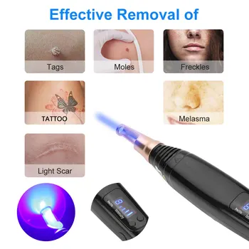 Professionele Laser Picosecond Pen Sproet Tattoo Removal Gericht Doel Lokaliseren Positie Mol Spot Wenkbrauw Pigment Remover Acn